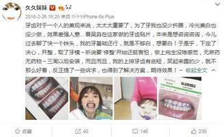 揭秘明星网红牙齿美容,明星笑容背后的秘密