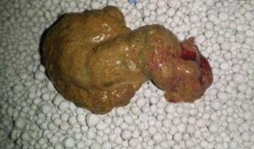 吃贝贝瓜屎会黑吗,吃贝贝瓜屎会变黑吗？