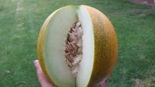 神经瓜上热门,揭秘大脑奥秘，探索神经科学前沿