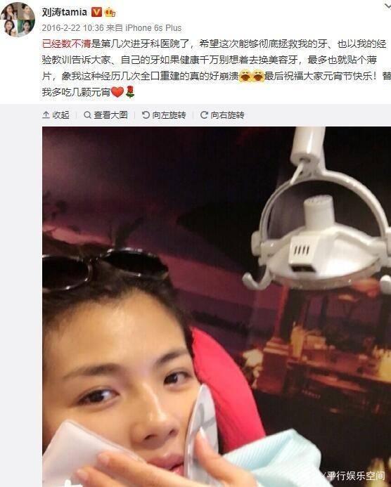 明星网红烤瓷牙,美丽笑容的秘密武器